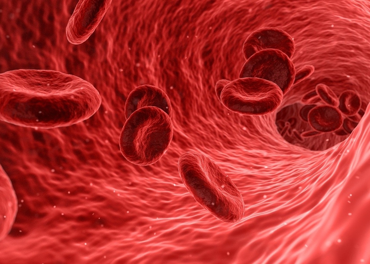 Effect of oral liposomal iron versus intravenous iron for the treatment of iron deficiency anemia in patients with CKD: a randomized study